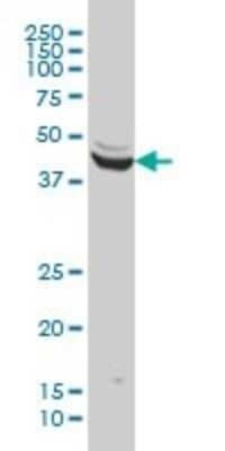 ENO3 Antibody (5D1), Novus Biologicals 0.1 mg | Buy Online | Novus Biologicals | Fisher Scientific