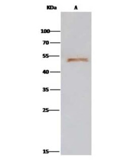 ENO3 Antibody, Novus Biologicals 100 &mu;g; Unconjugated:Antibodies, Polyclonal