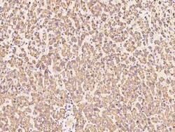 ENPP-2/Autotaxin Antibody, Novus Biologicals:Antibodies:Primary Antibodies