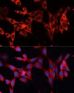 RhoC Rabbit anti-Human, Mouse, Rat, Polyclonal, Novus Biologicals:Antibodies:Primary