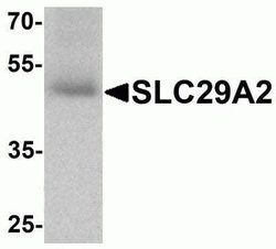 ENT2 Antibody - BSA Free, Novus Biologicals 0.1 mg; Unconjugated:Anticorps,