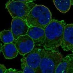 EPB41 Rabbit anti-Human, Polyclonal, Novus Biologicals 100 &mu;g | Buy Online | Novus Biologicals | Fisher Scientific