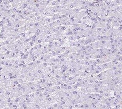 EPCR Antibody, Novus Biologicals 0.1 mL | Buy Online | Novus Biologicals | Fisher Scientific