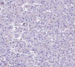 EPCR Antibody, Novus Biologicals 0.1 mL | Buy Online | Novus Biologicals | Fisher Scientific