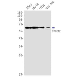 EPHX2 Antibody (S04-2F6), Novus Biologicals:Antibodies:Primary Antibodies