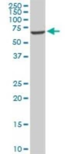 EPM2AIP1 Antibody (3H7), Novus Biologicals 0.1 mg | Buy Online | Novus Biologicals | Fisher Scientific
