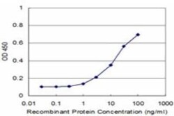 EPM2AIP1 Antibody (5G7), Novus Biologicals 0.1 mg | Buy Online | Novus Biologicals | Fisher Scientific
