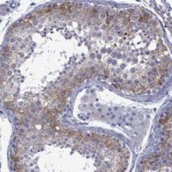 EPPIN-WFDC6 Rabbit anti-Human, Polyclonal, Novus Biologicals 25 &mu;g;