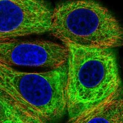 EPPK1 Antibody, Novus Biologicals:Antibodies:Primary Antibodies
