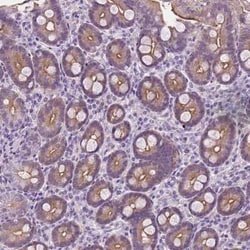 EPPK1 Antibody, Novus Biologicals:Antibodies:Primary Antibodies