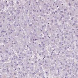 EPPK1 Antibody, Novus Biologicals:Antibodies:Primary Antibodies