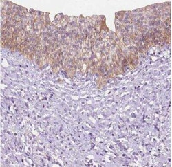 EPPK1 Antibody, Novus Biologicals:Antibodies:Primary Antibodies