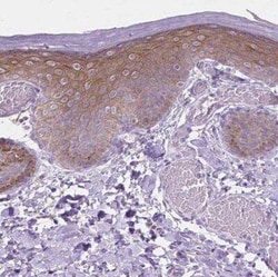 EPPK1 Antibody, Novus Biologicals:Antibodies:Primary Antibodies