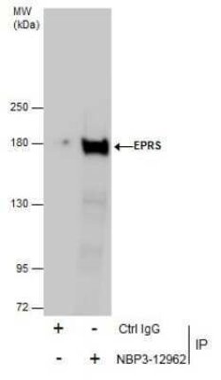 EPRS Antibody, Novus Biologicals 100 &mu;g | Buy Online | Novus Biologicals | Fisher Scientific