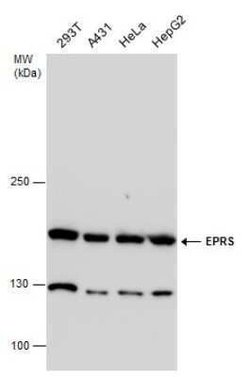 EPRS Antibody, Novus Biologicals 100 &mu;g | Buy Online | Novus Biologicals | Fisher Scientific