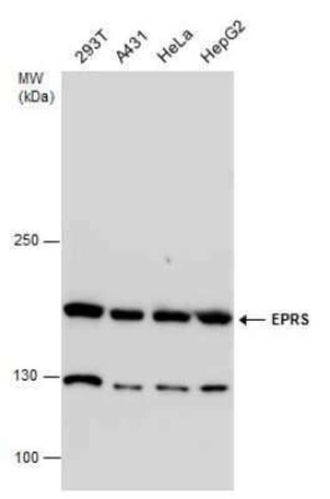 EPRS Antibody, Novus Biologicals 100 μg; UnconjugatedAntibodies