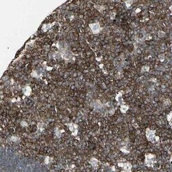 EPS15 Antibody, Novus Biologicals 0.1 mL | Buy Online | Novus Biologicals | Fisher Scientific