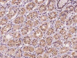 EPS15 Antibody, Novus Biologicals 100 &mu;g; Unconjugated:Antibodies, Polyclonal