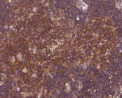 EPS15 Antibody, Novus Biologicals 100 &mu;g; Unconjugated:Antibodies, Polyclonal