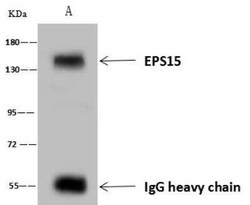 EPS15 Antibody, Novus Biologicals 100 &mu;g; Unconjugated:Antibodies, Polyclonal