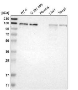 EPS15 Antibody, Novus Biologicals 0.1 mL | Buy Online | Novus Biologicals | Fisher Scientific