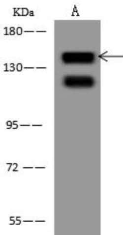 EPS15 Antibody, Novus Biologicals 100 &mu;g; Unconjugated:Antibodies, Polyclonal
