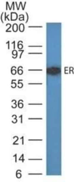 ER alpha/NR3A1 Antibody (ER505), Novus Biologicals 0.1mg; Unlabeled:Antibodies,