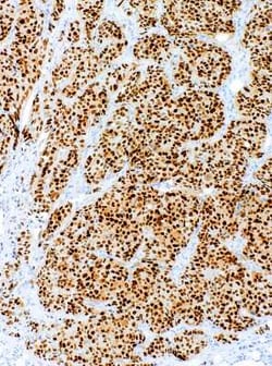 ER alpha/NR3A1 Rabbit anti-Human, Clone: IHC423, Novus Biologicals:Antibodies:Primary
