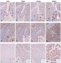 ER beta/NR3A2 Antibody (57/3) - Azide and BSA Free, Novus Biologicals 0.025