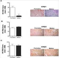 ER beta/NR3A2 Antibody (57/3) - Azide and BSA Free, Novus Biologicals 0.025