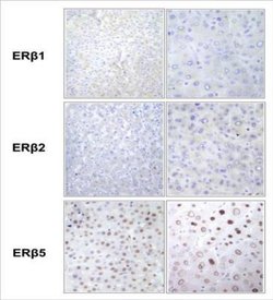 ER beta/NR3A2 Antibody (57/3) - Azide and BSA Free, Novus Biologicals 0.025