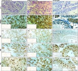 ER beta/NR3A2 Antibody (57/3) - Azide and BSA Free, Novus Biologicals 0.025