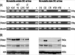 ER beta/NR3A2 Antibody (57/3) - Azide and BSA Free, Novus Biologicals 0.025