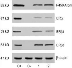 ER beta/NR3A2 Antibody (57/3) - Azide and BSA Free, Novus Biologicals 0.025