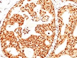 ER beta/NR3A2 Antibody (ERb455), Novus Biologicals 0.1mg; Unlabeled:Antibodies,