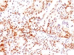 ER beta/NR3A2 Antibody (ERb455), Novus Biologicals 0.1mg; Unlabeled:Antibodies,