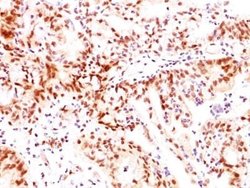 ER beta/NR3A2 Antibody (ERb455), Novus Biologicals 0.1mg; Unlabeled:Antibodies,