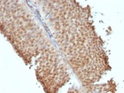 ER beta/NR3A2 Antibody (ERb455), Novus Biologicals 0.1mg; Unlabeled:Antibodies,