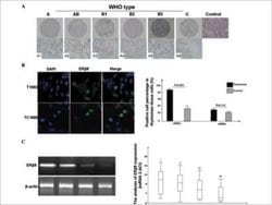 ER beta/NR3A2 Antibody (PPG5/25) - Azide and BSA Free, Novus Biologicals