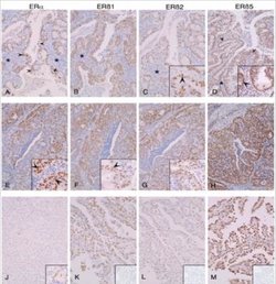 ER beta/NR3A2 Antibody (PPG5/25) - Azide and BSA Free, Novus Biologicals