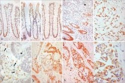 ER beta/NR3A2 Antibody (PPG5/25) - Azide and BSA Free, Novus Biologicals