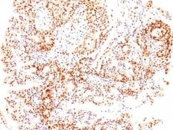 ER beta/NR3A2 Antibody (ESR2/686), Novus Biologicals 0.1mg; Unlabeled:Antibodies,