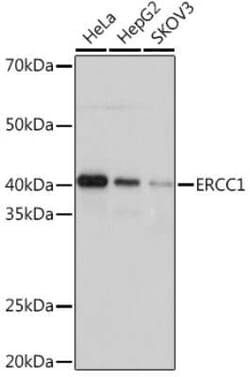 ERCC1 Rabbit anti-Human, Clone: 5F9U0, Novus Biologicals 100 &mu;g | Buy Online | Novus Biologicals | Fisher Scientific