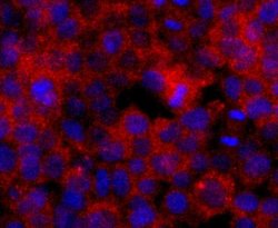ERCC1 Rabbit anti-Human, Clone: JM10-07, Novus Biologicals 100&mu;L:Antibodies,