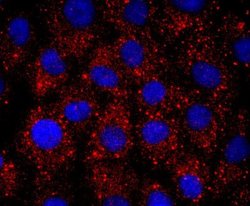 ERCC1 Rabbit anti-Human, Clone: JM10-07, Novus Biologicals 100&mu;L:Antibodies,