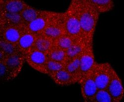 ERCC1 Rabbit anti-Human, Clone: JM10-07, Novus Biologicals 100&mu;L:Antibodies,