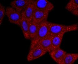 ERCC1 Rabbit anti-Human, Clone: JM10-07, Novus Biologicals 100&mu;L:Antibodies,
