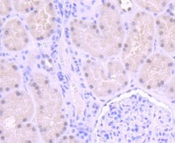 ERCC1 Rabbit anti-Human, Clone: JM10-07, Novus Biologicals 100&mu;L:Antibodies,