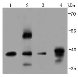 ERCC1 Rabbit anti-Human, Clone: JM10-07, Novus Biologicals 100&mu;L:Antibodies,
