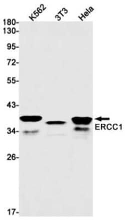 ERCC1 Rabbit anti-Human, Mouse, Clone: S08-7E3, Novus Biologicals 100 &mu;g | Buy Online | Bio-Techne | Fisher Scientific